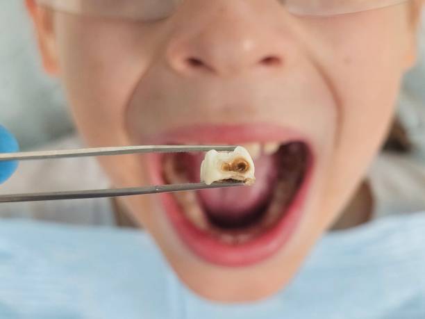 Best Tooth Infection Emergency Dentist  in Toronto, OH