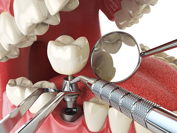 Best Tooth Infection Emergency Dentist  in Toronto, OH